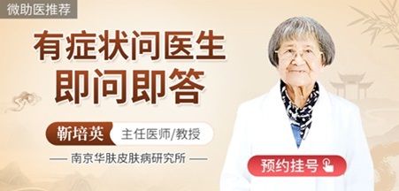 南京皮肤病医院哪家好？手掌蜕皮严重是什么原因！