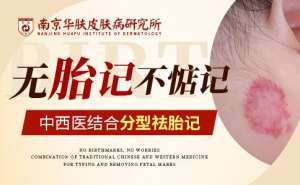 胎痣和胎记的区别“南京胎记去除哪个医院好”
